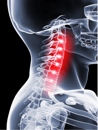 Participate in a Stanford Chronic Pain Study and Receive $200 Cash 4