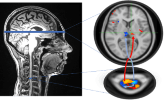 Postdoctoral Fellow Position in Simultaneous Spinal Cord-Brain fMRI 1