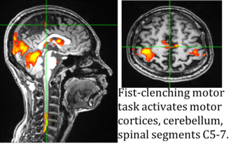 Postdoctoral Fellow Position in Simultaneous Spinal Cord-Brain fMRI 2
