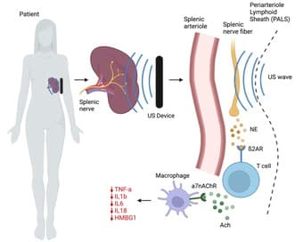 Research Study on US and Immunity - Enrolling Now 1